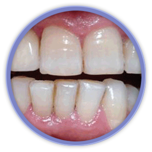 cirugia-oral-1